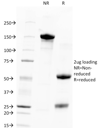 Data from SDS-PAGE analysis of Anti-TROP2 antibody (Clone TACSTD2/2151). Reducing lane (R) shows heavy and light chain fragments. NR lane shows intact antibody with expected MW of approximately 150 kDa. The data are consistent with a high purity, intact mAb.